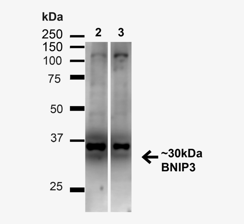 Western Blot - Monochrome, transparent png #8376519