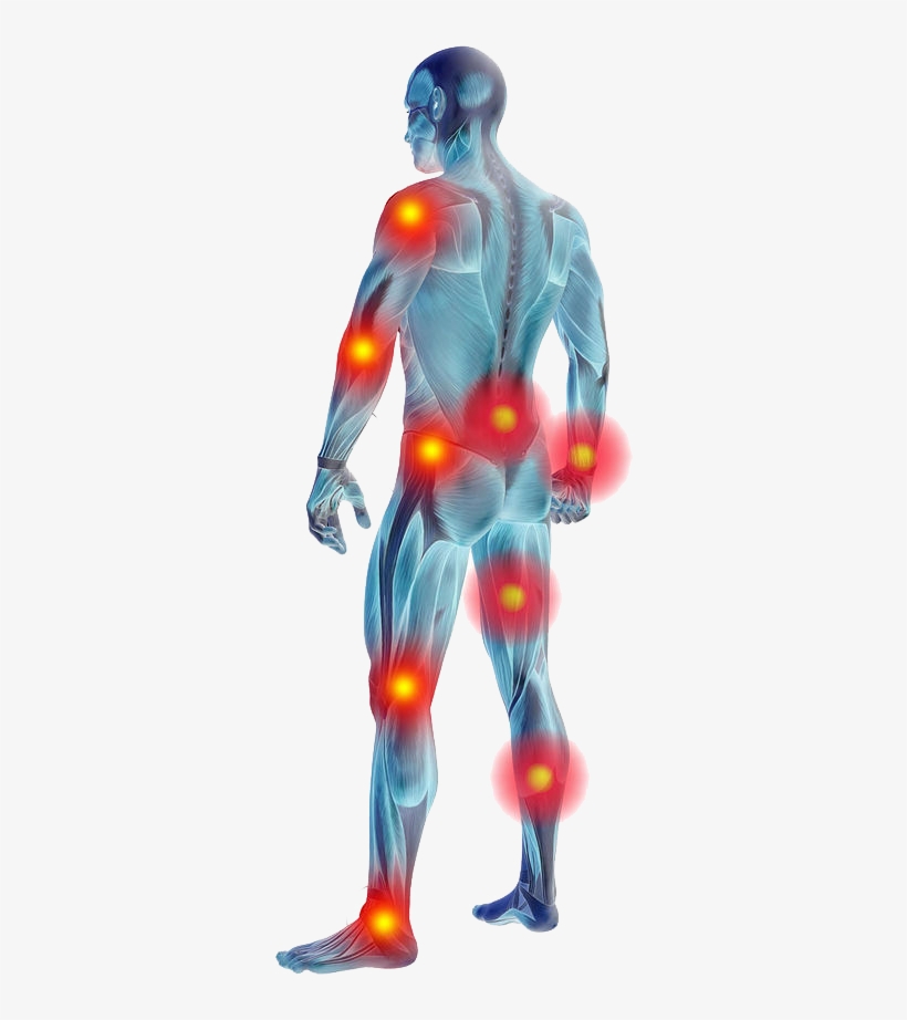 Muscle Pain Remedies - Muscle Pain Png, transparent png #8424846