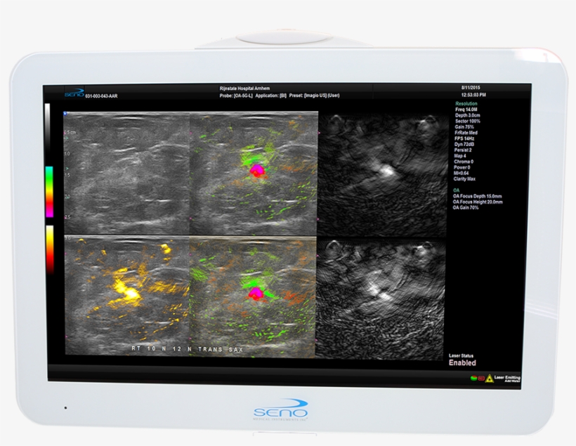 Monitor-950w - Seno Medical, transparent png #8454341
