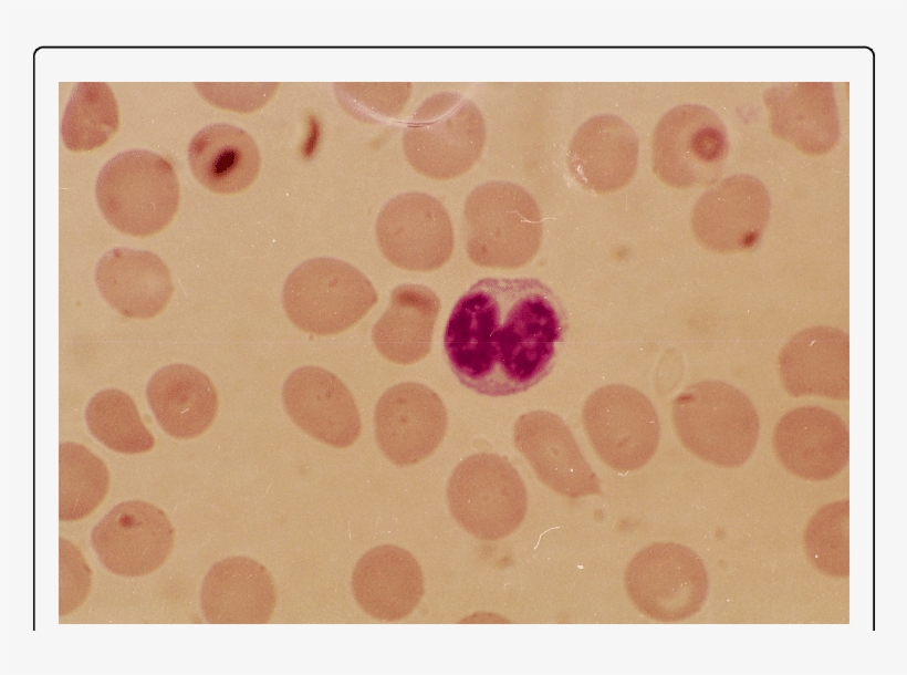 Lymphocyte With A Dumbbell Shaped Nucleus - Circle, transparent png #8517801
