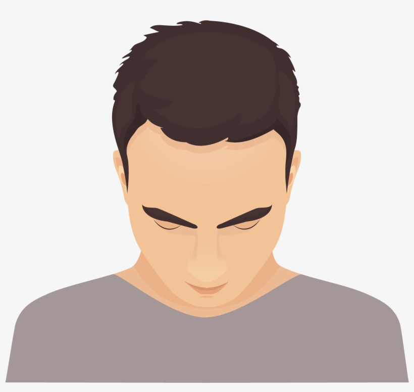 If Baldness Runs In Your Family Either On Your Father - Hair Transplant, transparent png #8541575