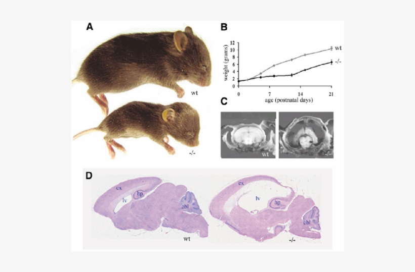 Mdnah5 / Mouse (bottom) And Normal Control Littermate Hydrocephalus