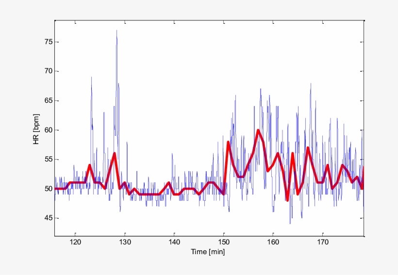 Heart Rate From The Ppg Sensor Of Somnoscreen And Basis - Diagram, transparent png #8574659