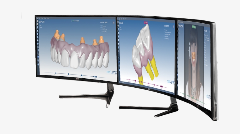 Cad-lynx - 3d Dental Cad, transparent png #8583388