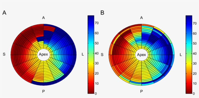 Bull's-eye Plots Of Depolarization Times From A Patient - Semantic Web, transparent png #8583684