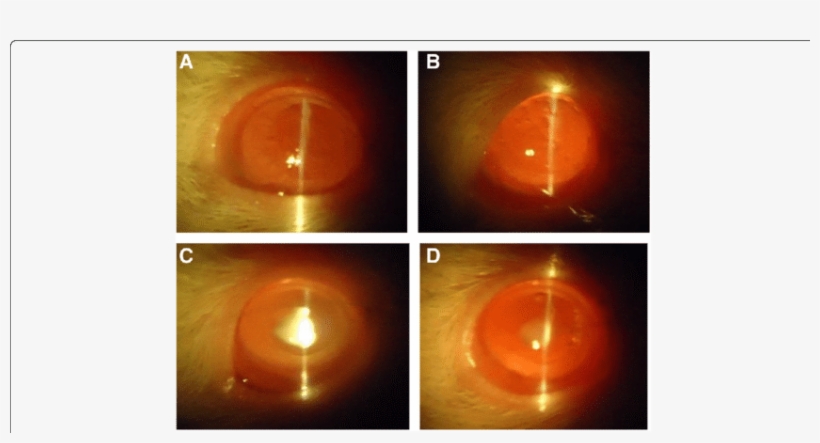 Slit Lamp Images Of Eyes - Light, transparent png #8621884