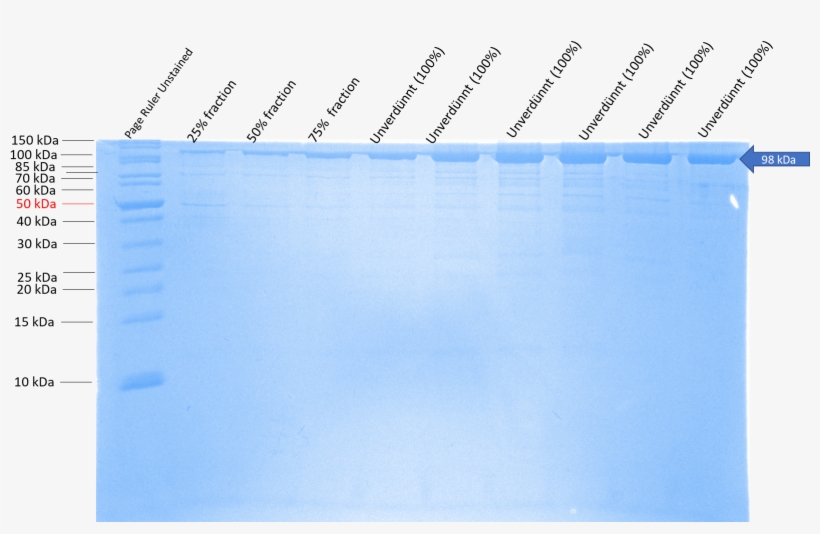 Sbsb Wt - Document, transparent png #8636848