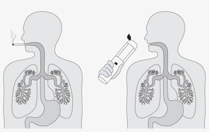 Rationale For Pulmonary Delivery To Manage The Premetastatic - Illustration, transparent png #8643977