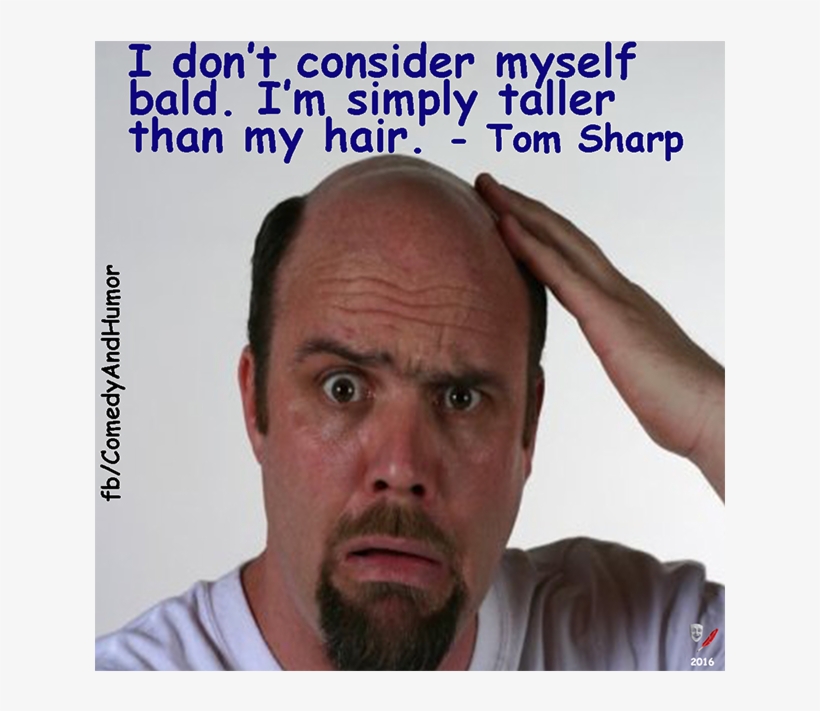 Bald Man Touching His Head - Old Men With Receding Hairline, transparent png #8650585