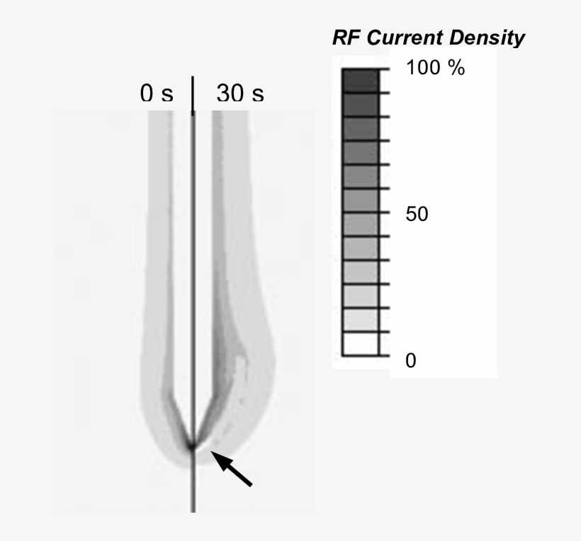Electrical Rf Current Density For Cooled Needle Electrode - Sketch, transparent png #8708621