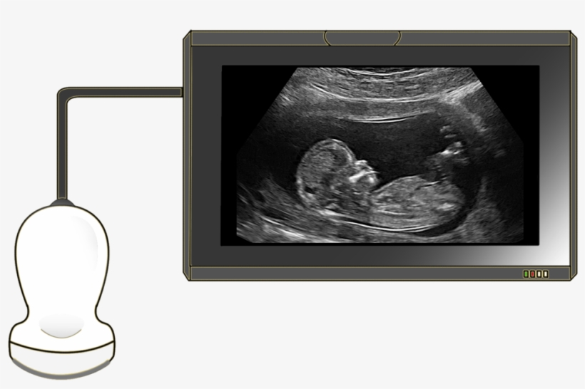 Ultrasound - Cuarto Mes De Embarazo Ecografia, transparent png #8712649