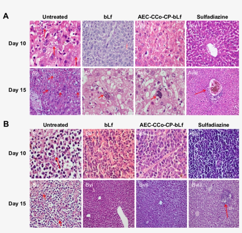 Histpathological Analysis In Liver And Spleen At Day - Art, transparent png #8741947