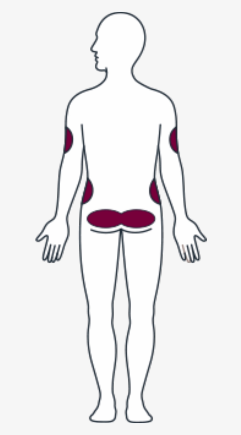 Back Side Appropriate Injection Sites - Illustration, transparent png #8748835