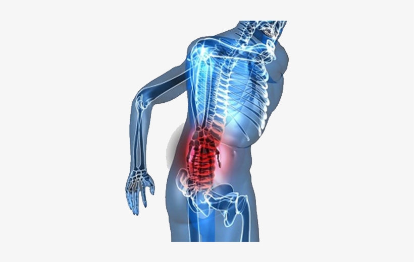All Of Us Have Experienced Back Pain Of Some Degree - Uric Acid Causes Back Pain, transparent png #8769276