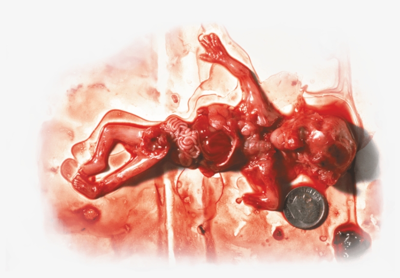 Free Png Download Not Your Body Abortion Meme Png Images - Marie Stopes Abortion Kenya, transparent png #8818709