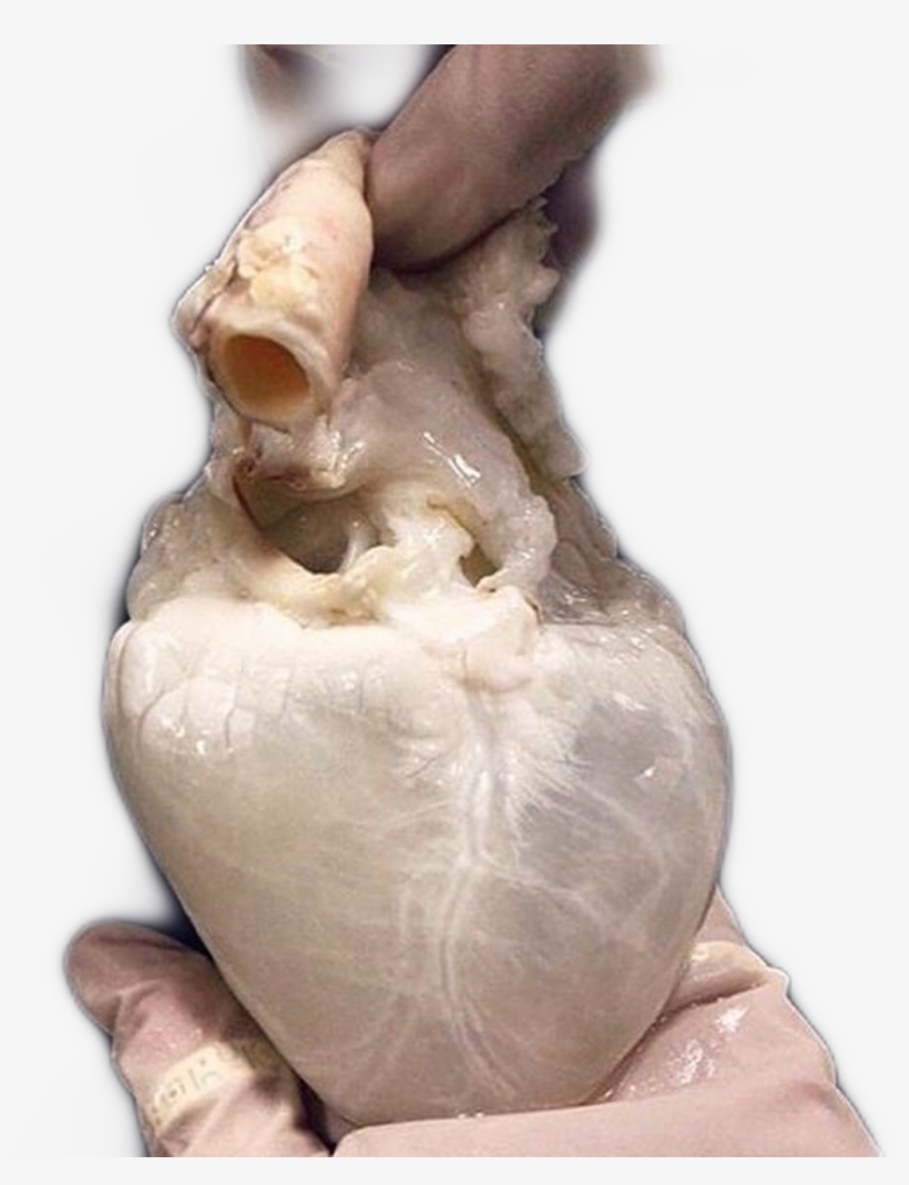 Heart Sticker - Human Heart Drained Of Blood, transparent png #8898093
