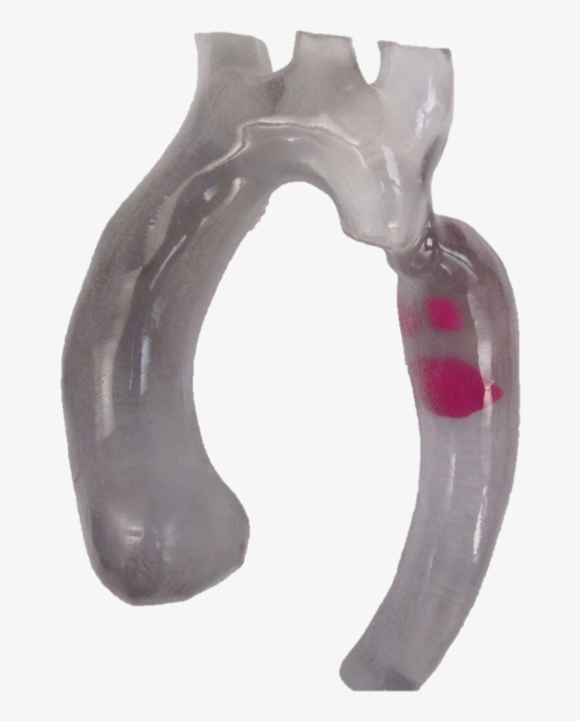 3d Printed Aortic Arch With Thrombus - Diagonal Pliers, transparent png #8907619