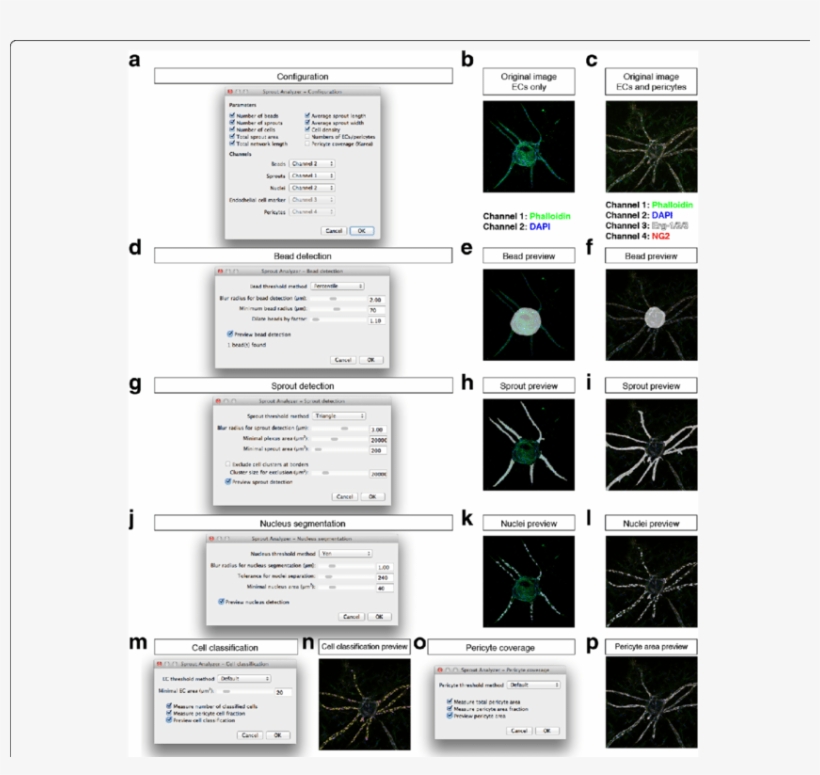 Configuration Of The Sprout Analyzer Plugin - Component Testing Using Cro, transparent png #8928192