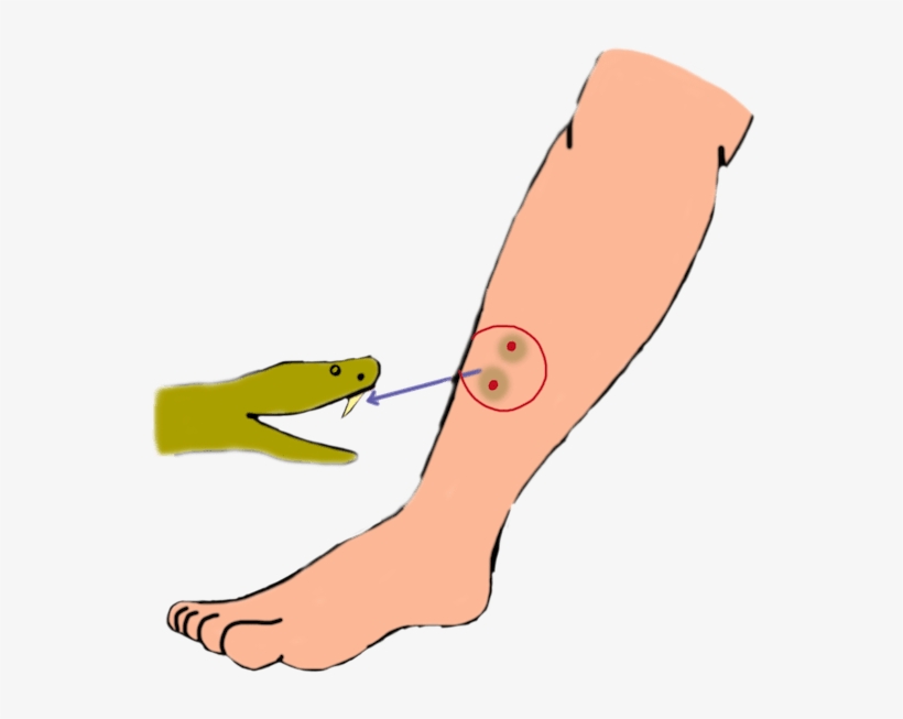 Treatment -, transparent png #8939307