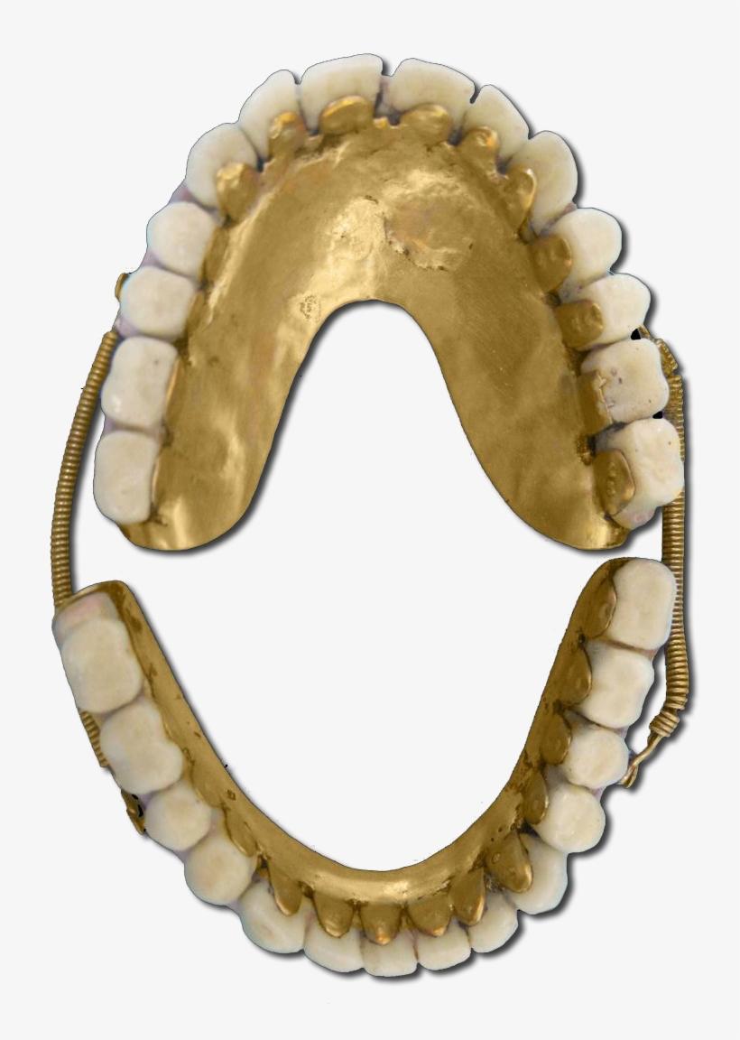 Gold Dentures Scream Gold Transparent Teeth - Jaw, transparent png #8954565