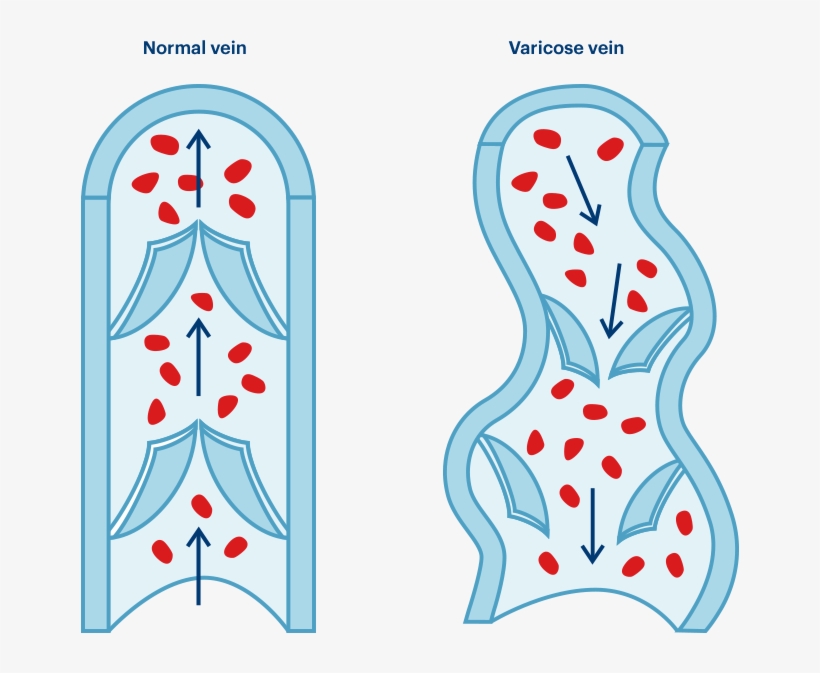 Comparaison Comparaison - Illustration, transparent png #8992164