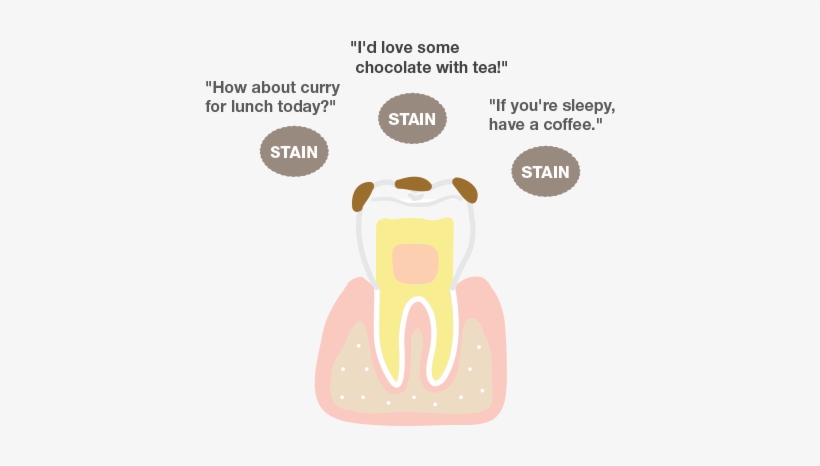 Stain 'i'd Love Some - Sunstar, transparent png #908364