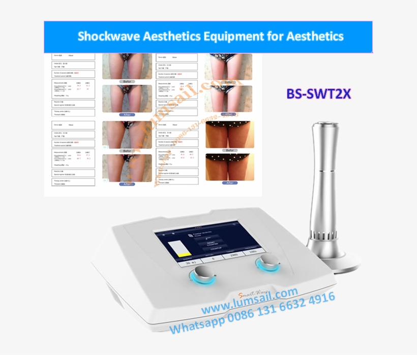 Shock Wave Therapy Equipment Both Muscle And Tendon - Smart Wave 2x, transparent png #9008650