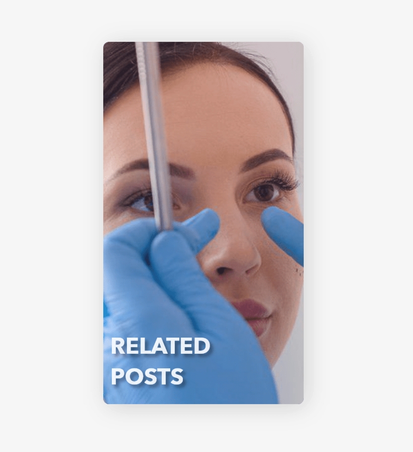 Nose Surgery Related Posts - Rhinoplasty, transparent png #9009616