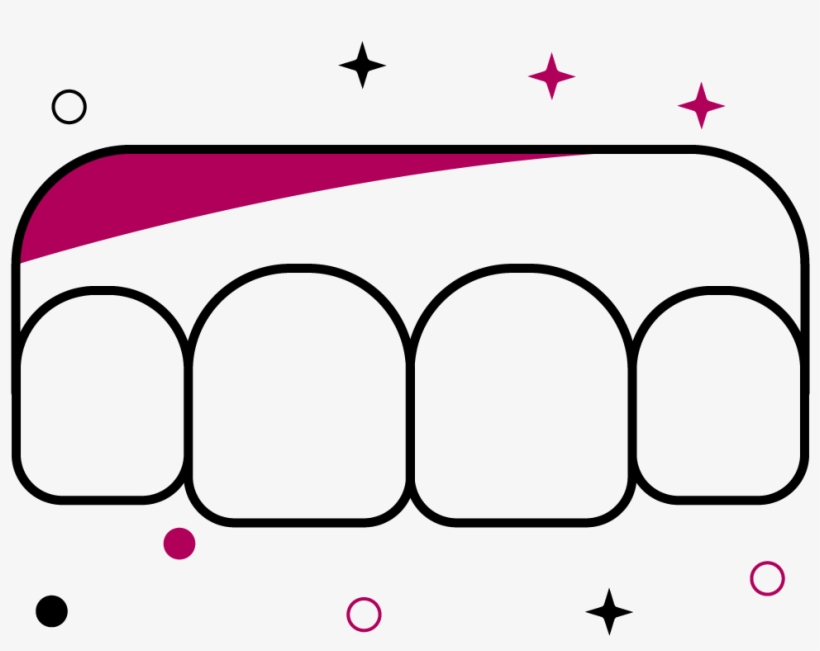 Aesthetic Gum Surgery - Diagram, transparent png #9009631