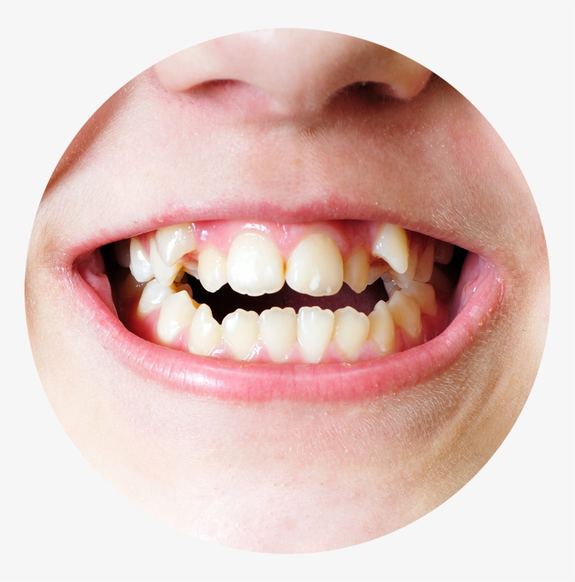 Common Related Problems Of The Teeth, transparent png #9010561