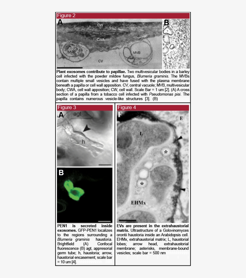 Do Plant Cells Secrete Evs - Medical Imaging, transparent png #9039650