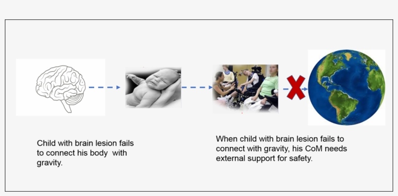 Child With Brain Lesion Can Not Connect To Gravity - Sphere, transparent png #9063521