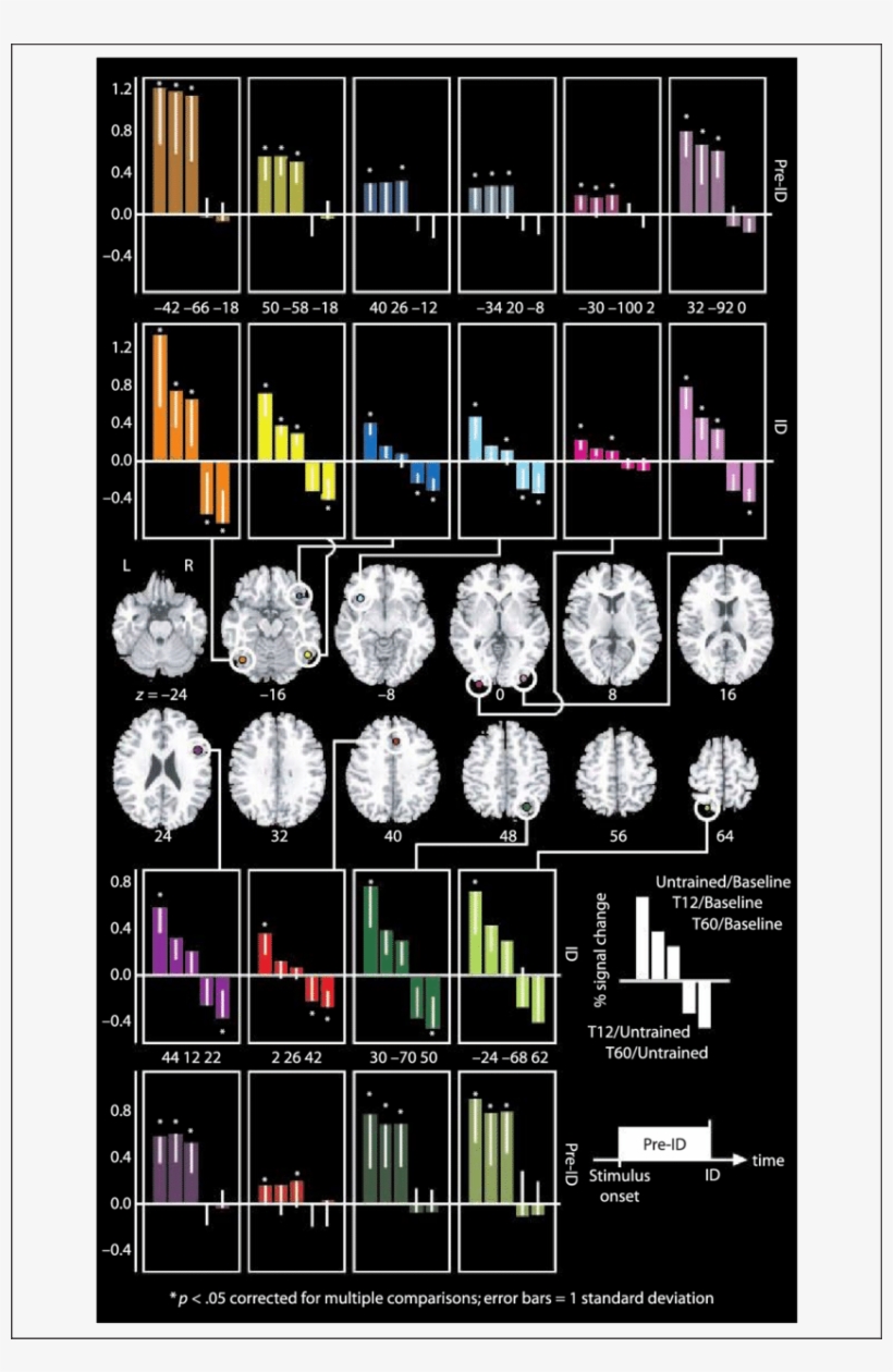 Percent Signal Change For Each Roi, Showing That Training - Broca Wernicke, transparent png #9068977