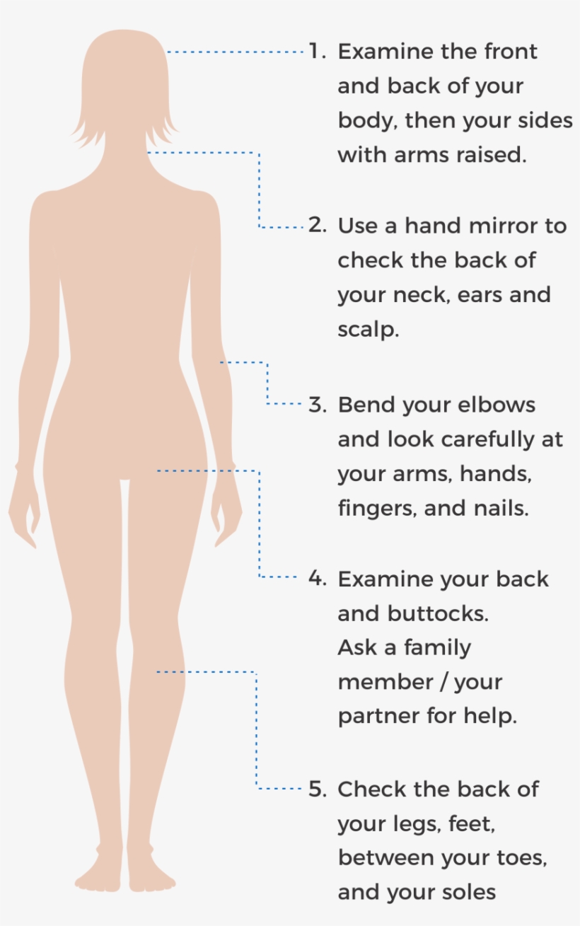 How To Check Your Skin Spots - Standing, transparent png #9090055
