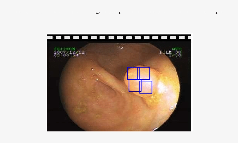 Polyps Sub-image Selection Is In General Not Overlapping - Planet, transparent png #9090369