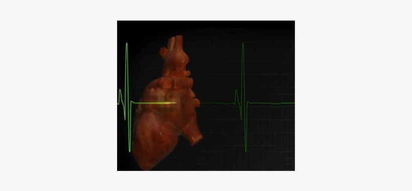 A “band-aid” To Heal Hearts - Plant, transparent png #916771