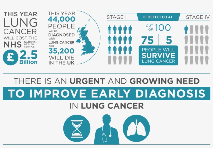 Lucid Rh Owlstonemedical Com Lung Cancer Quotes Lung - Lung Cancer Infographic Uk, transparent png #9110239