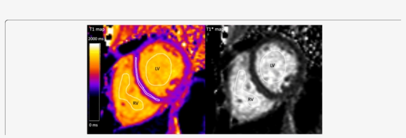 The Figure Shows Regions Of Interest Drawn For Native - Circle, transparent png #923639