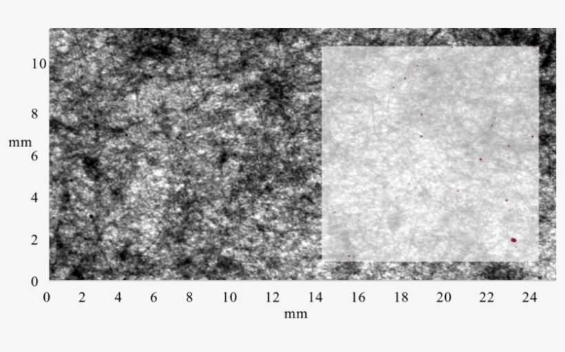 Radiographic Images Of 26 Lb - Granite, transparent png #928363