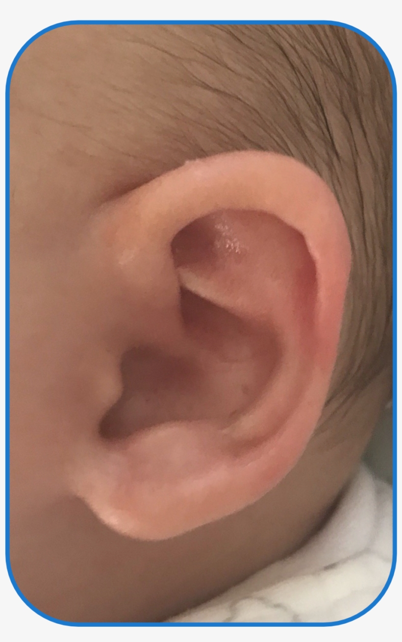 Ear Buddies Parent Review - Flesh, transparent png #9202158