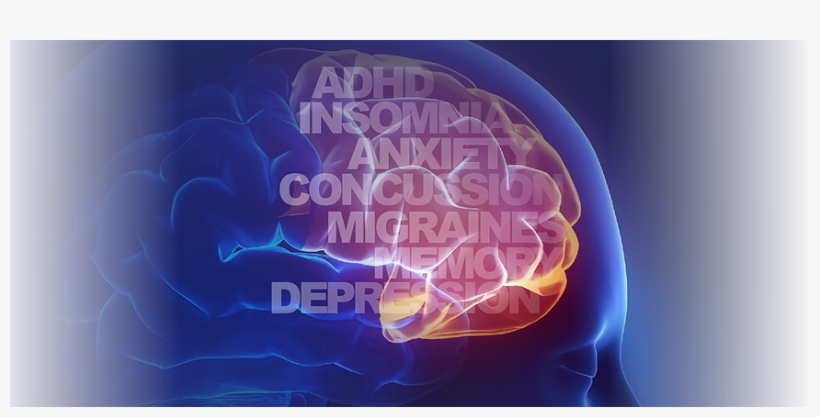 A New Frontier In Brain Health - Illustration, transparent png #9264095