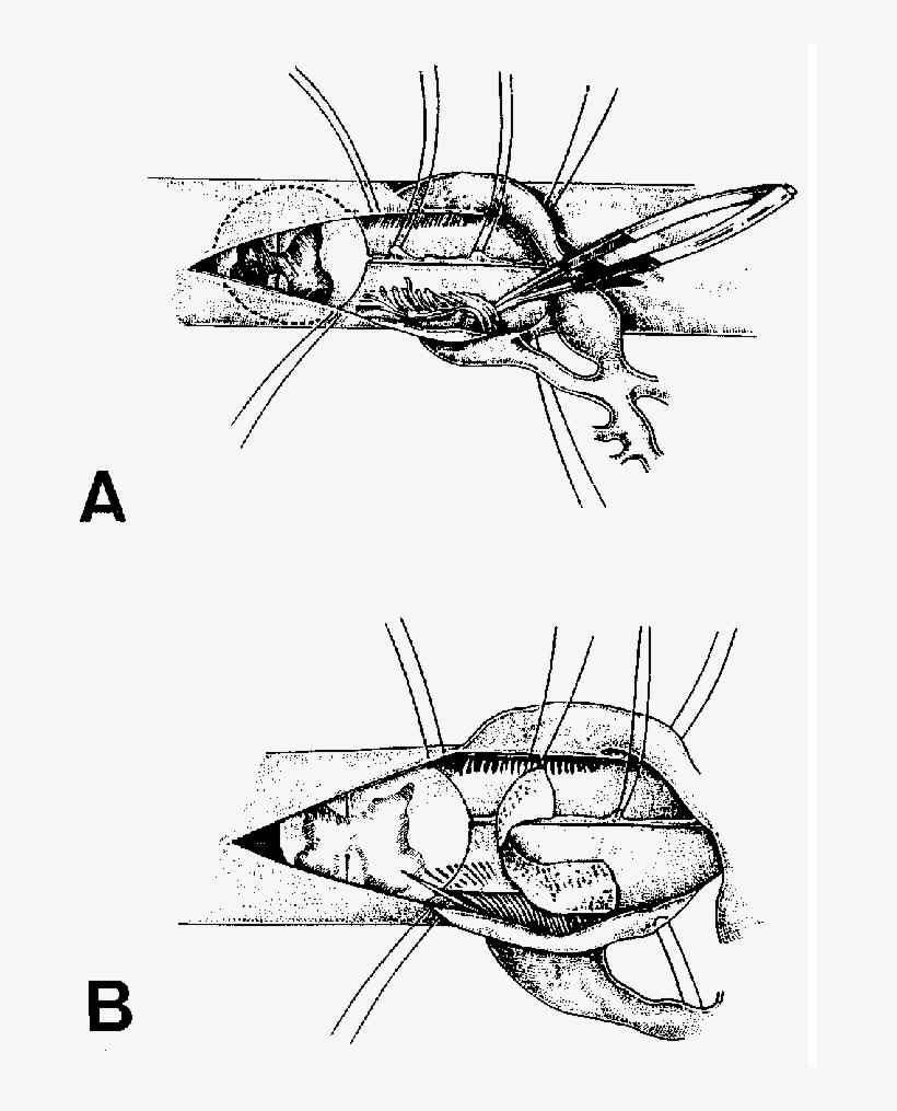 The Spinal Cord Is Cross Sectioned To Show The Depth - Insect, transparent png #9303231