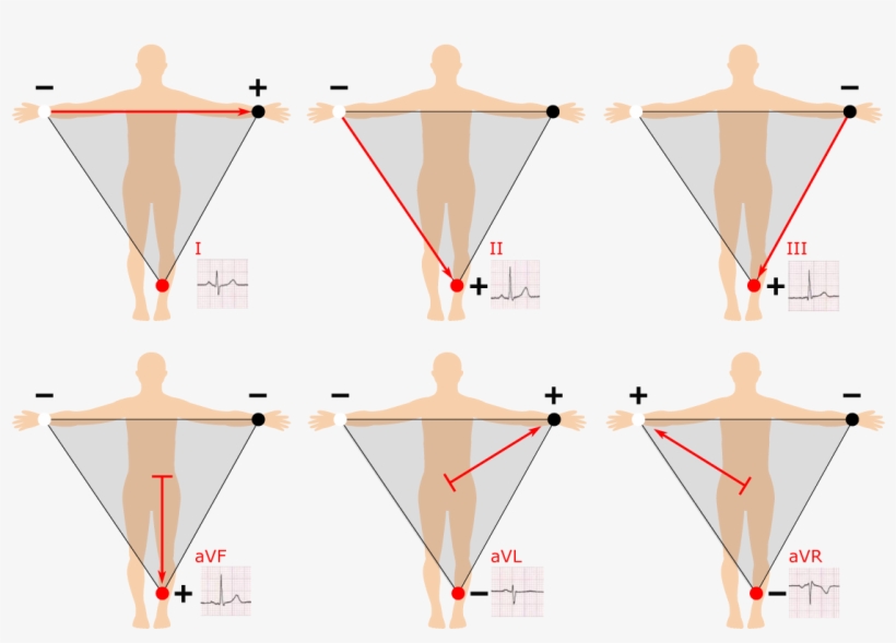 Einthoven's Triangle, transparent png #9350239