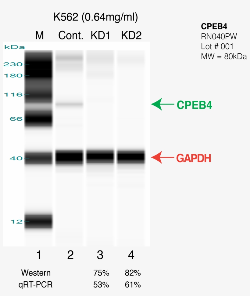 Cpeb4-k562 - Symmetry, transparent png #9361013