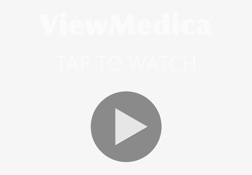 Gynecologic Laparoscopy - Circle, transparent png #9387574