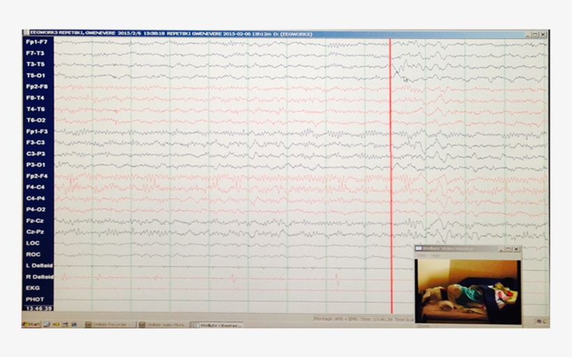 This Eeg Was Strikingly Different From Her Previous - Bedroom, transparent png #9398982