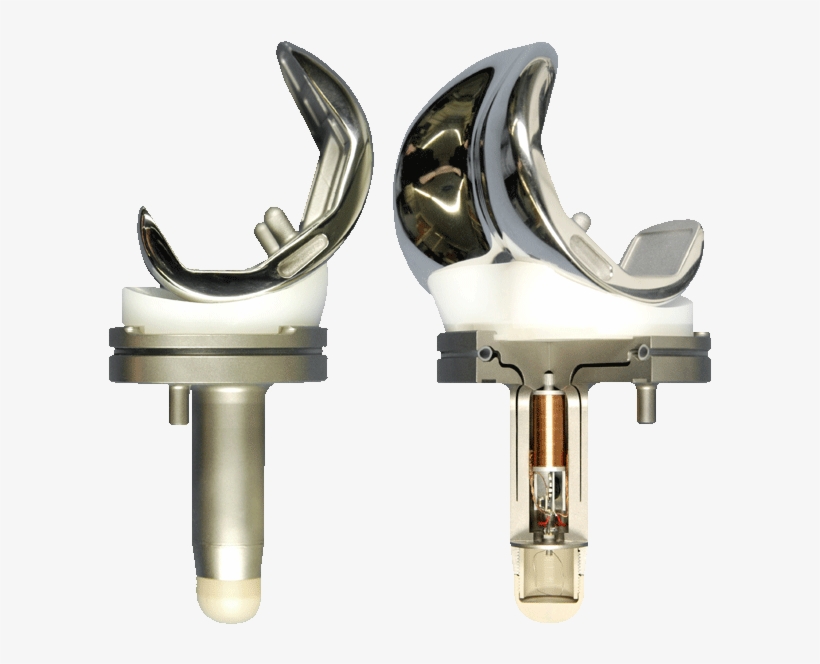 File - Knieprothese - Total Joint Prosthesis Depuy, transparent png #948897