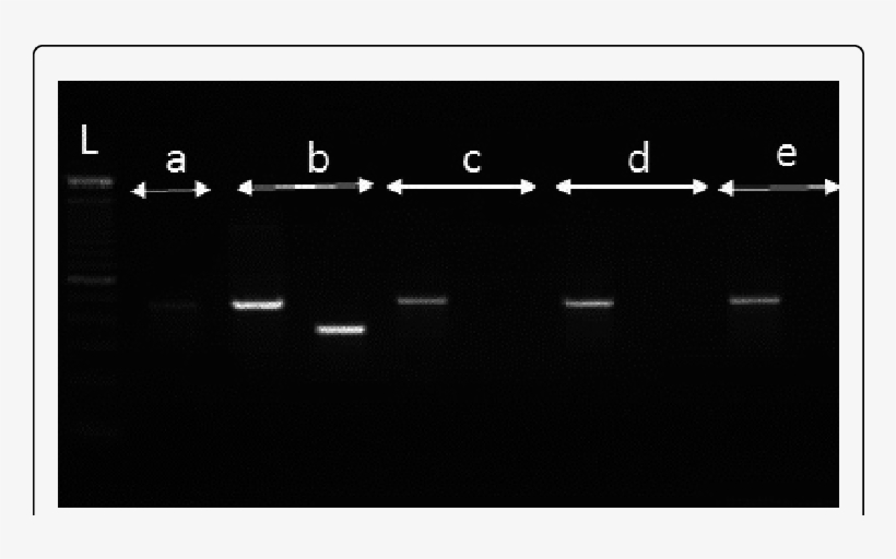 Photograph Of A Gel Showing The Separated Pcr Products - Monochrome, transparent png #9523396