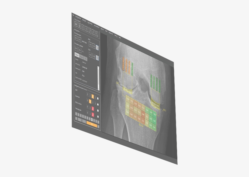 Image Biopsy Lab Software Laptop Image Biopsy Lab Software - Flat Panel Display, transparent png #9534724