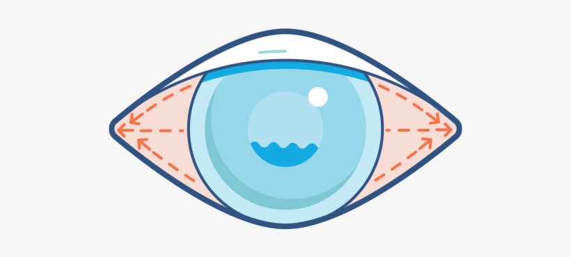 Eyeball Clipart Vision Loss - Circle, transparent png #9595451